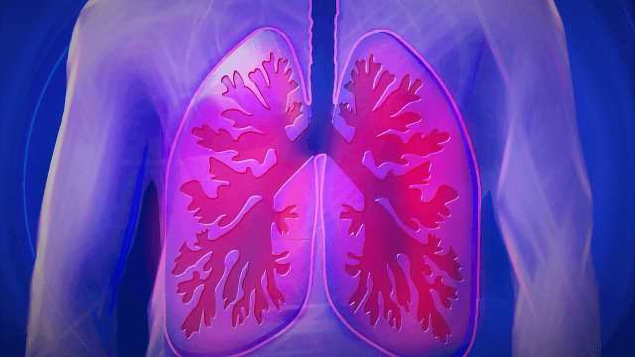 One Step Closer to Precision Medicine for Chronic Lung Disease Sufferers