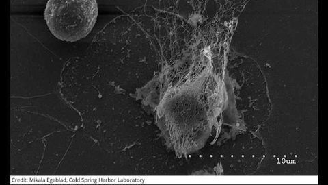 Immune-Cell Traps May Aid Cancer Metastasis