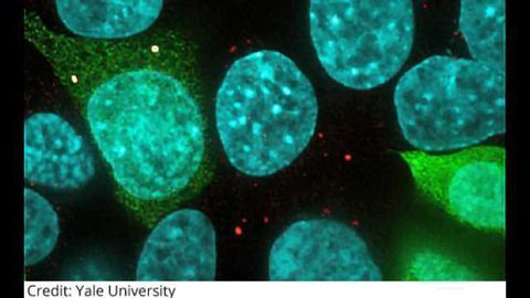 ‘NoBody,’ a Microprotein On a Mission