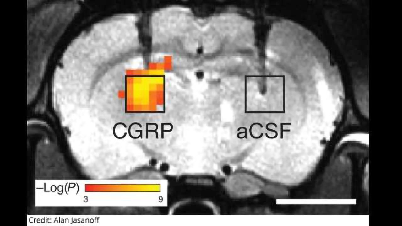 Radiation-Free Imaging in the Brain