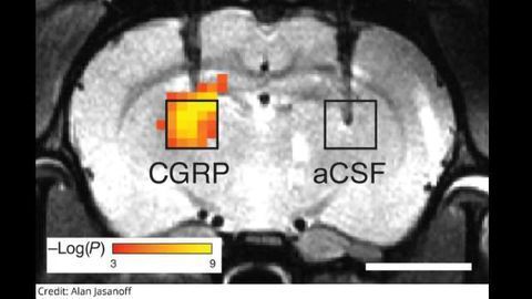 Radiation-Free Imaging in the Brain