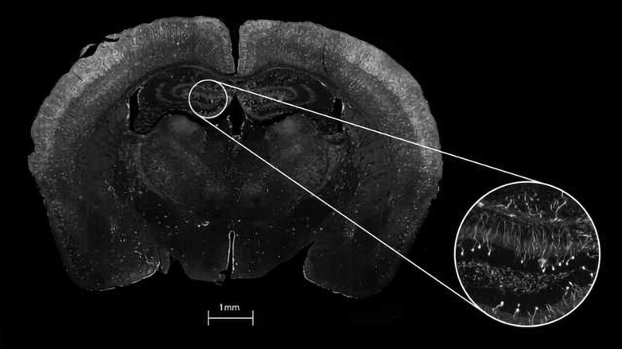 Caliber I.D. to Debut New Class Of Confocal Microscope