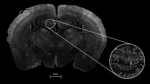 Caliber I.D. to Debut New Class Of Confocal Microscope