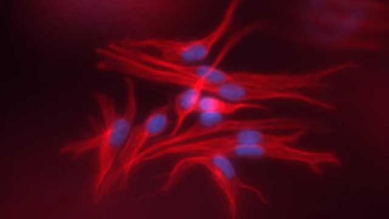 Modelling Corneal Disease with RAFT