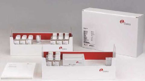 New Lung Cancer Test is Now Available in Europe
