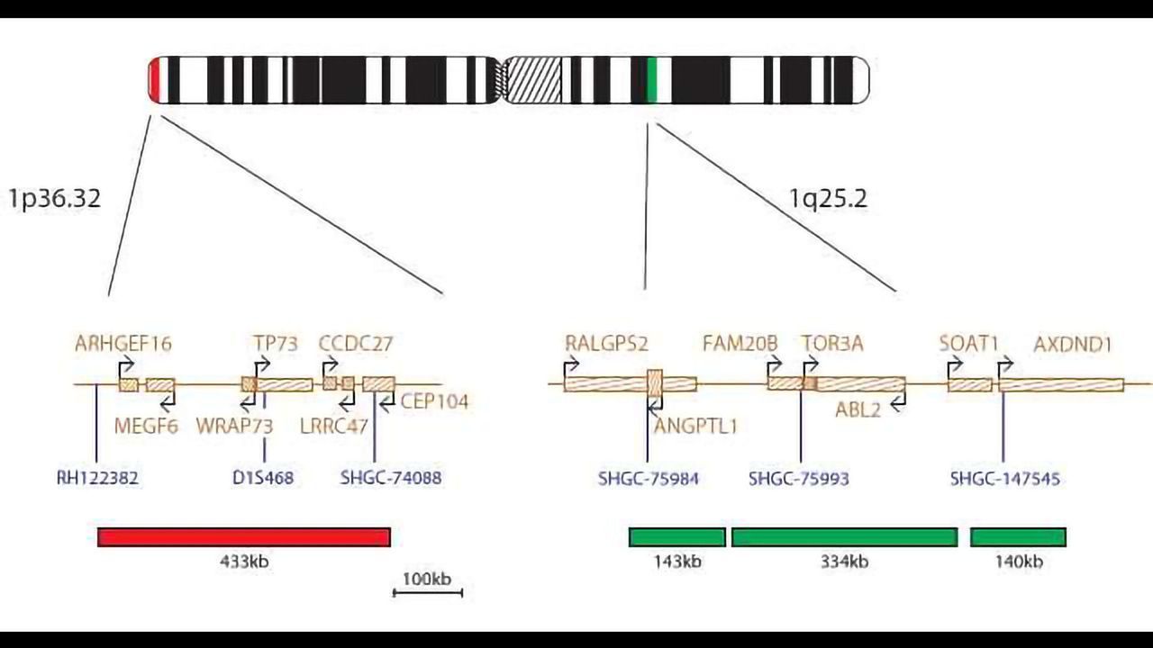 OGT Launches Cytocell FISH Probes for Glial Tumours