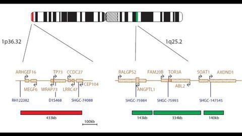 OGT Launches Cytocell FISH Probes for Glial Tumours