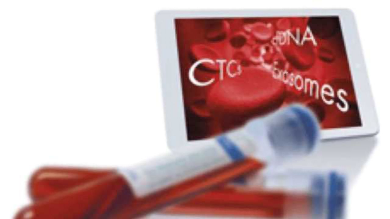 QIAGEN’s Liquid Biopsy Portfolio – from Sample to Insight