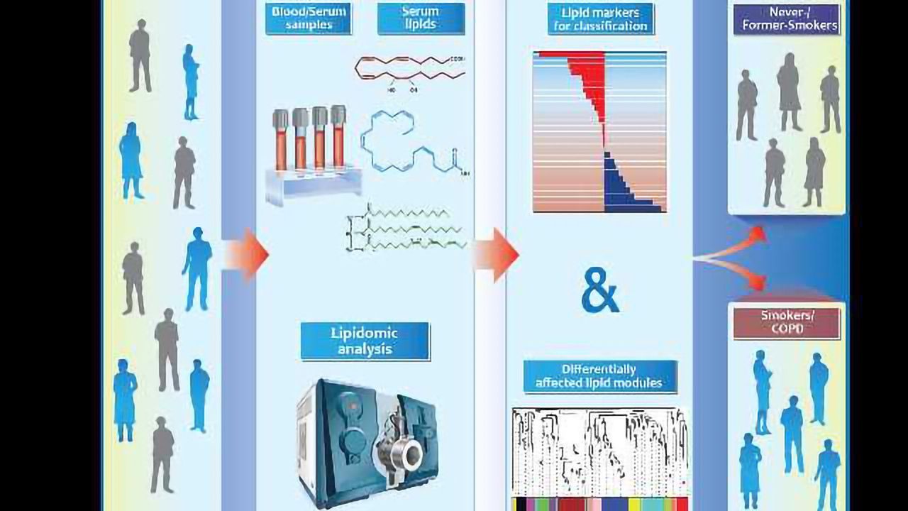 Multi-Lipid Profiling and COPD