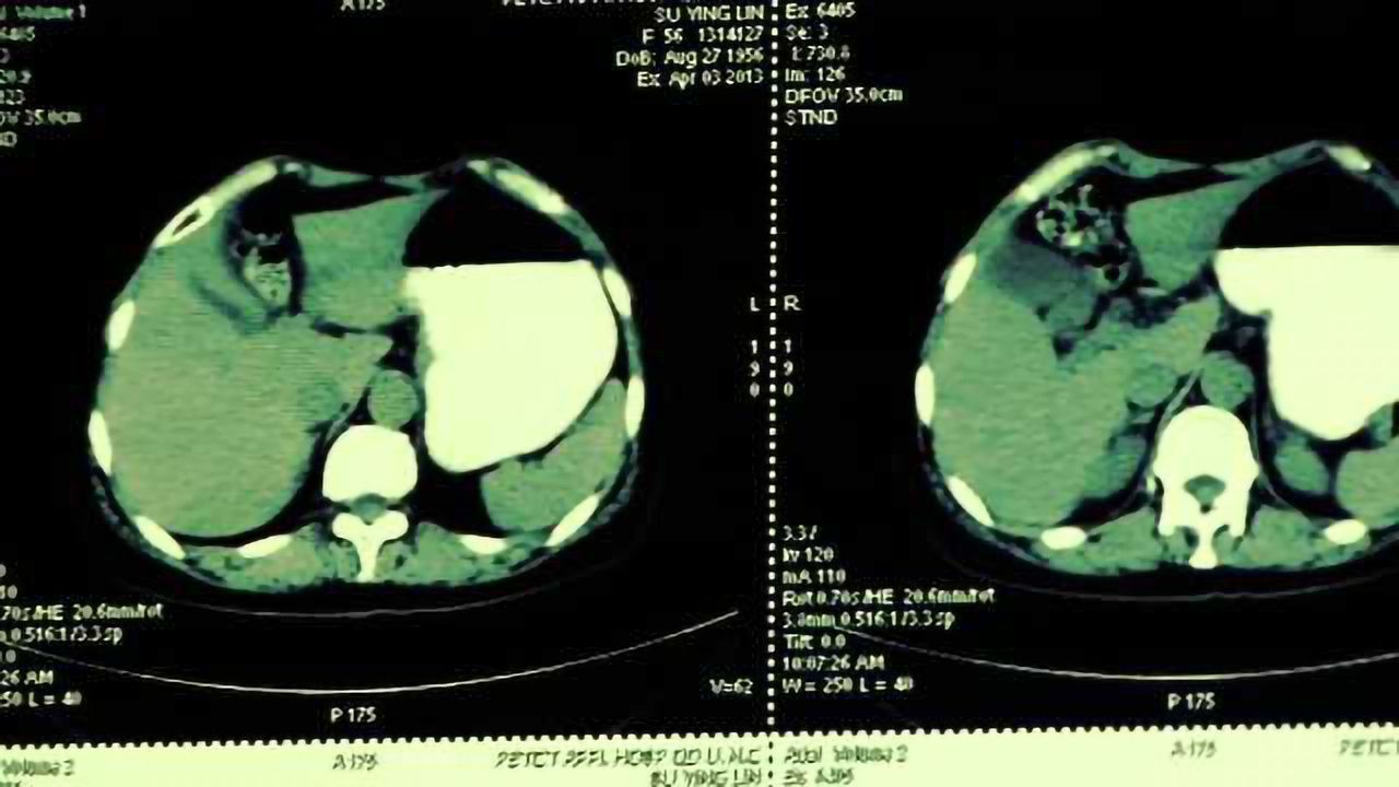 Investigating Three Dimensional Culture of iCell Hepatocytes for Regenerative Medicine Applications