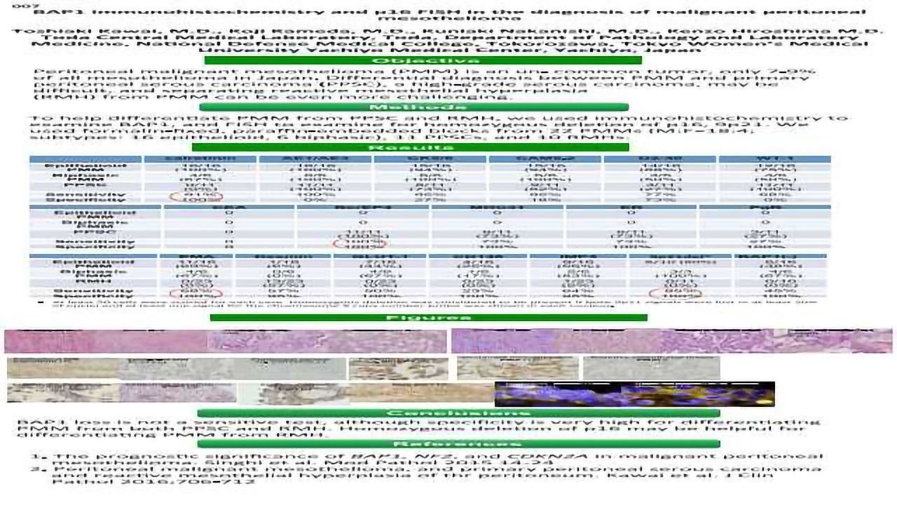 BAP1 Immunohistochemistry and p16 FISH in the Diagnosis of Malignant Peritoneal Mesothelioma