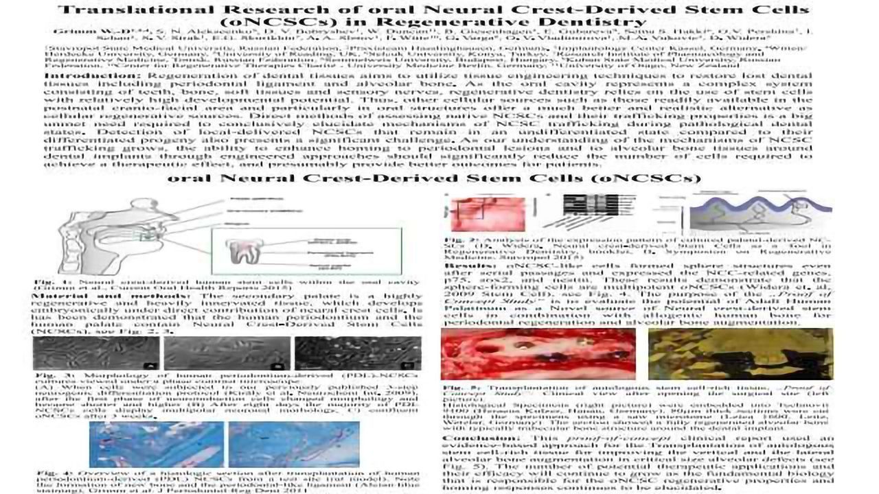 Translational Research of Oral Neural Crest-Derived Stem Cells (oNCSCs) in Regenerative Dentistry