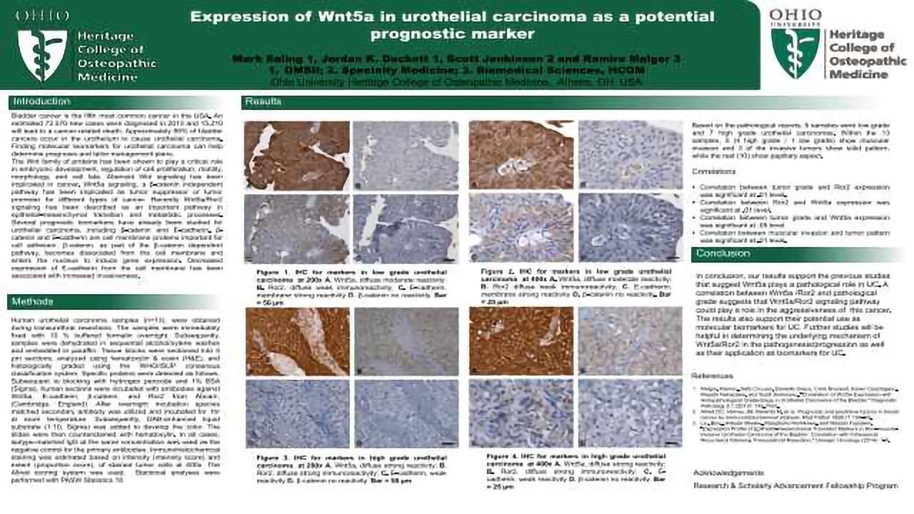 Expression of Wnt5a in Urothelial Carcinoma as a Potential Prognostic Marker