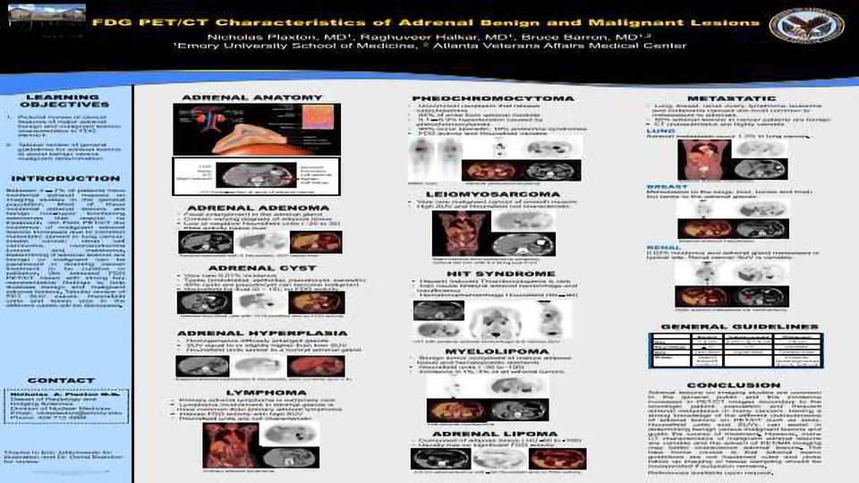 FDG PET/CT Characteristics of Adrenal Benign and Malignant Lesions content piece image