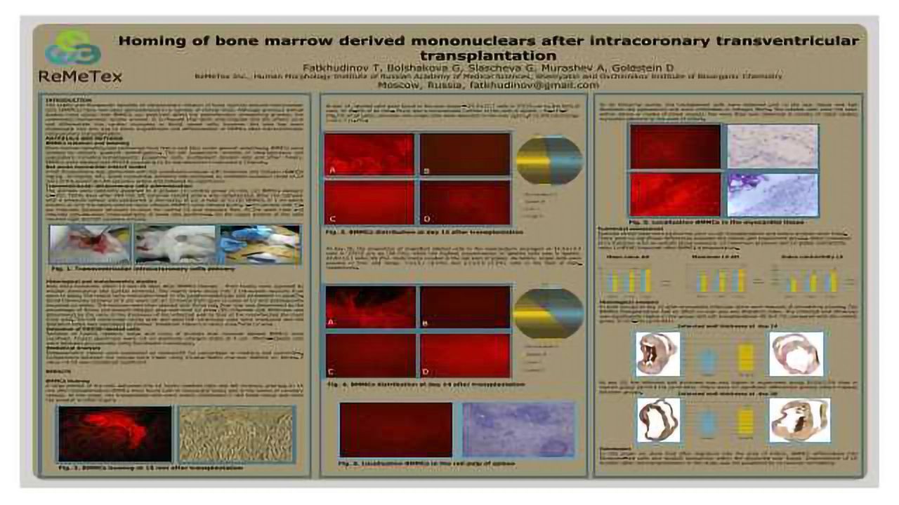 Homing of bone marrow derived mononuclears after intracoronary transventricular transplantation