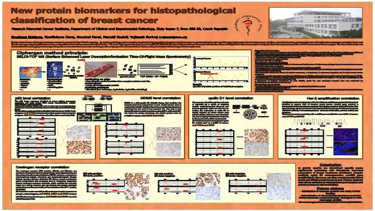 New Protein Biomarkers for Histopathological Classification of Breast Cancer