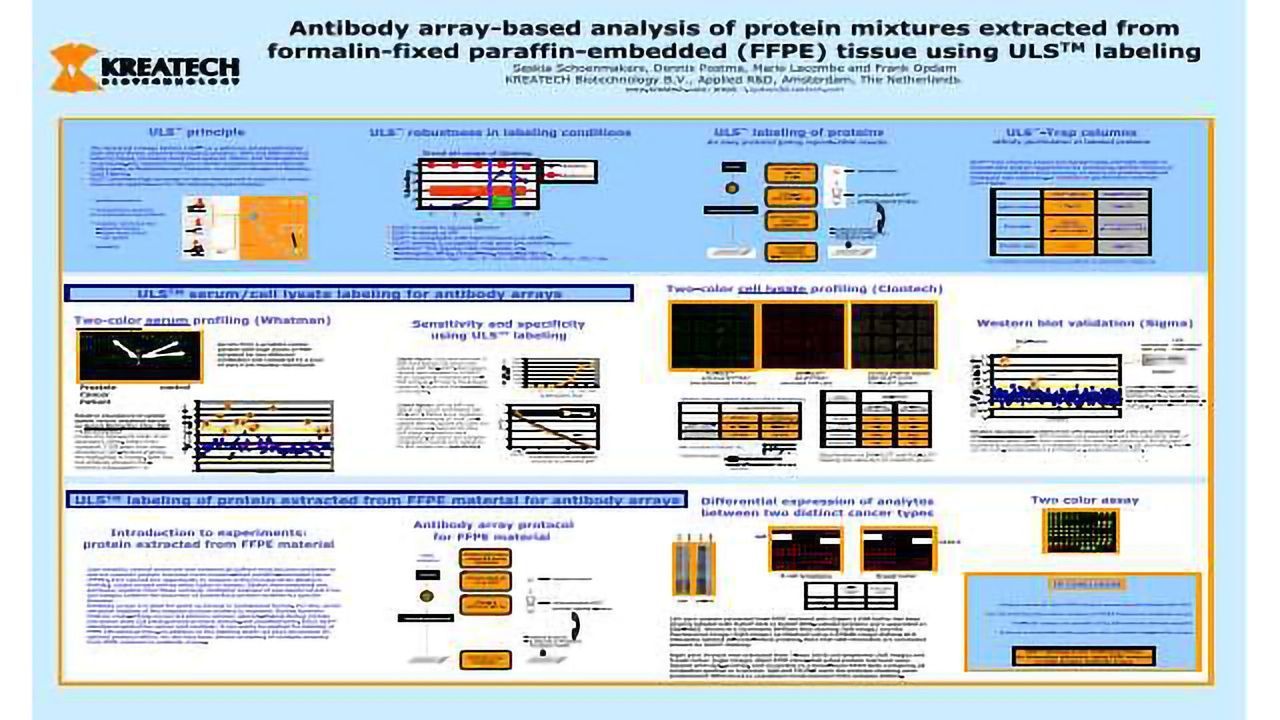 2-DE Analysis of Breast Cancer Cell Lines MDA-1833 and MDA-4175 with Distinct Metastatic Organ-Specific Potentials and Comparison with Parental Cell Line MDA-MB-231