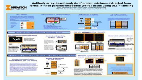 2-DE Analysis of Breast Cancer Cell Lines MDA-1833 and MDA-4175 with Distinct Metastatic Organ-Specific Potentials and Comparison with Parental Cell Line MDA-MB-231