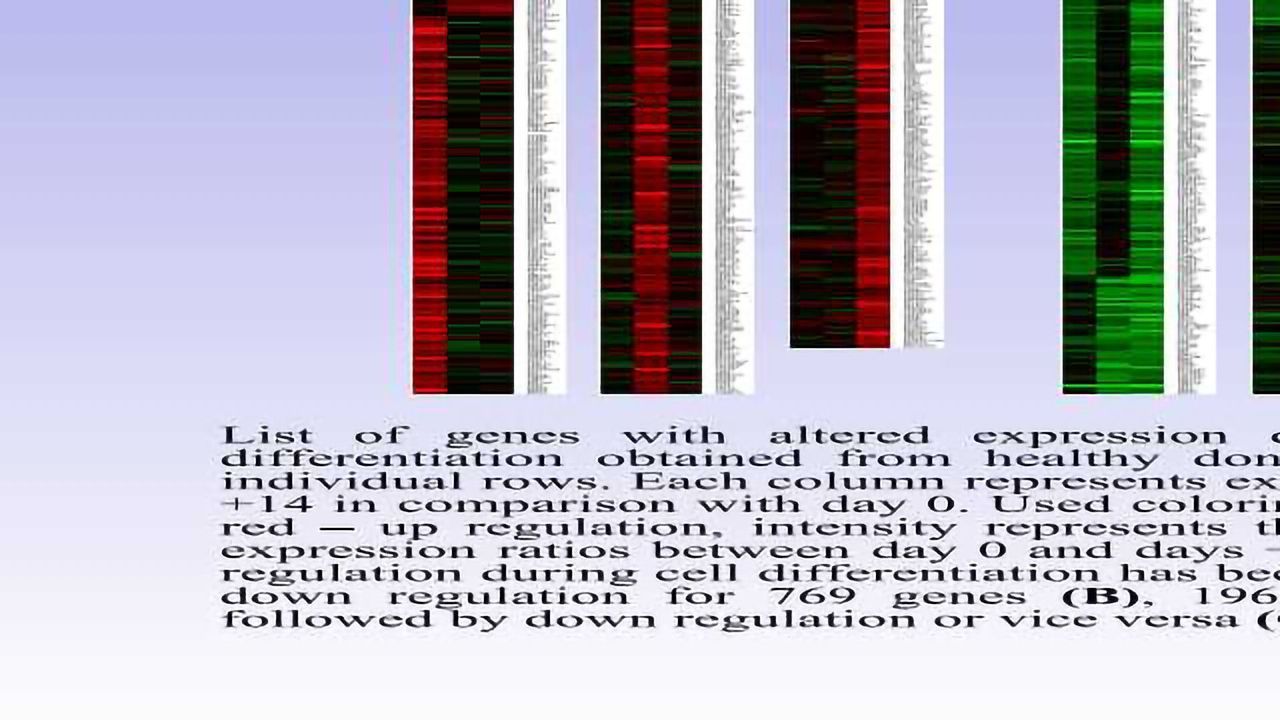 Expression Profiling of CD34+ of Peripheral Blood of Patients with Lymphoma During ex vivo Granulocytic Differentiation