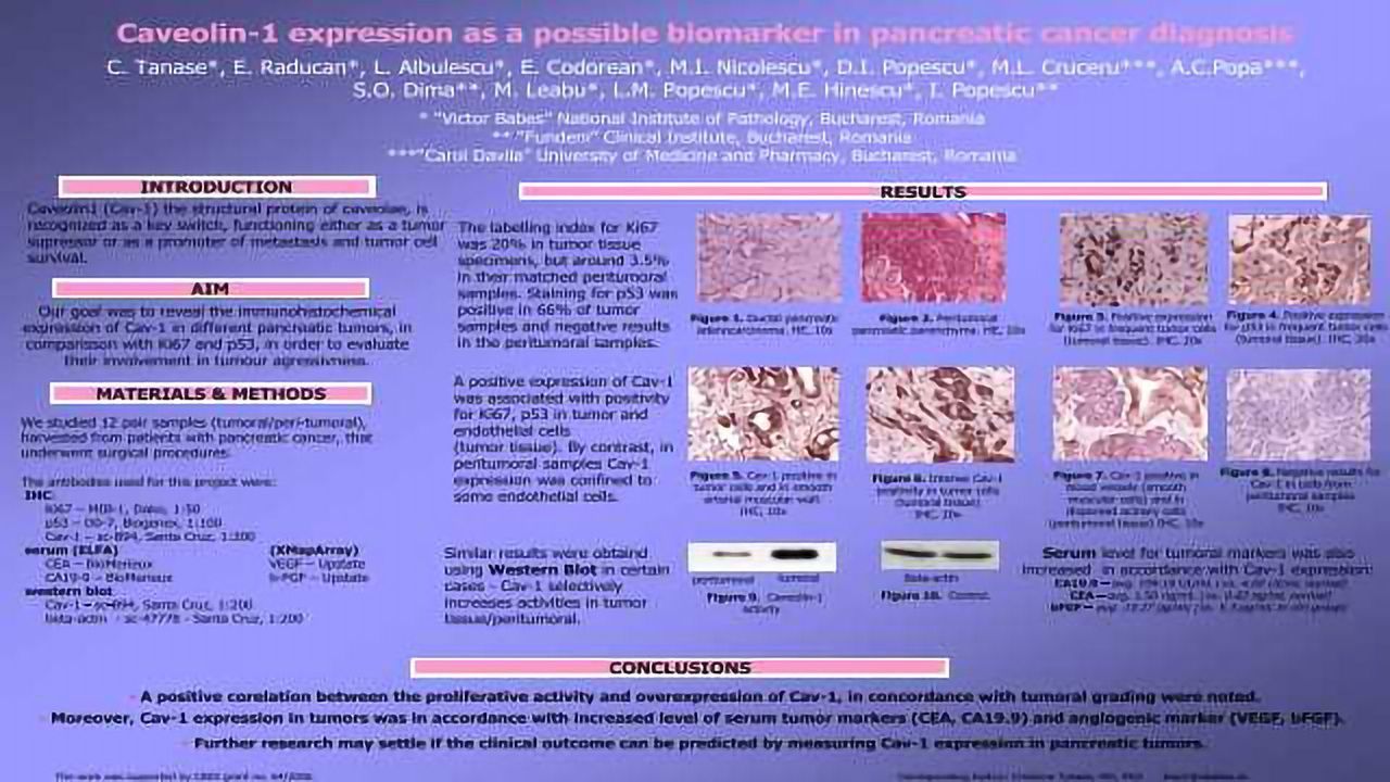 Caveolin-1 Expression as a Possible Biomarker in Pancreatic Cancer Diagnosis