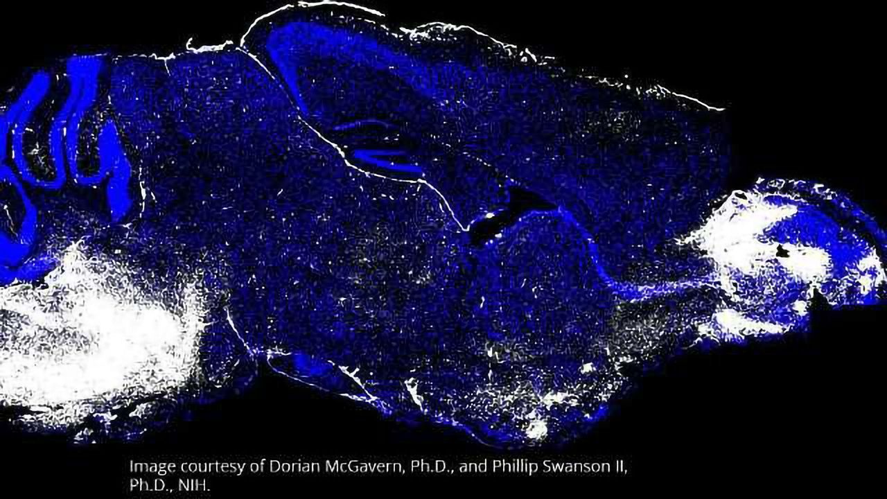 Uncovering Cerebral Malaria’s Deadly Agents