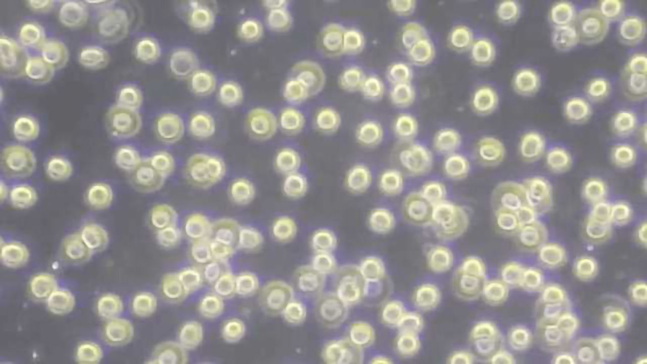 Bone Marrow-on-a-Chip