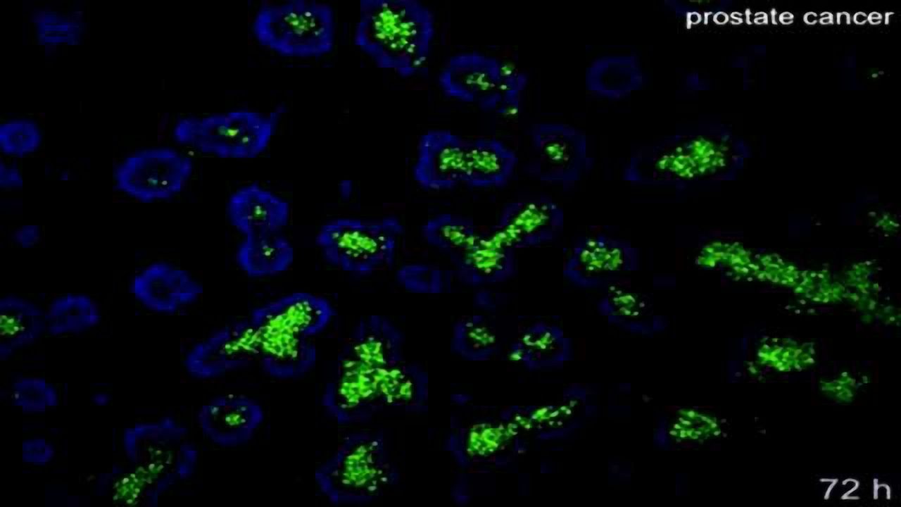 Complex Tissue Models that Mimic the Tumour Microenvironment, Heterogeneity and Invasion of Cancer