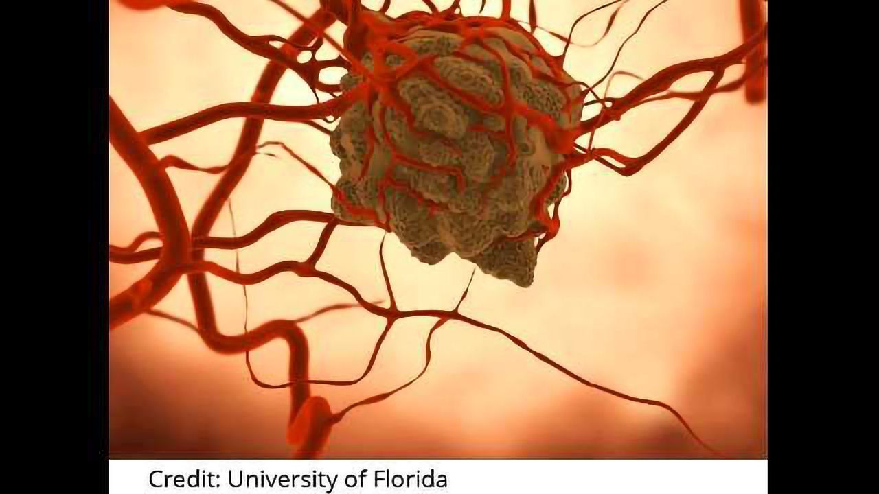 Tumor Cells Bolster Their Own Blood Supply
