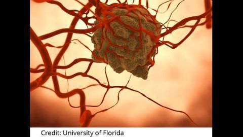 Tumor Cells Bolster Their Own Blood Supply