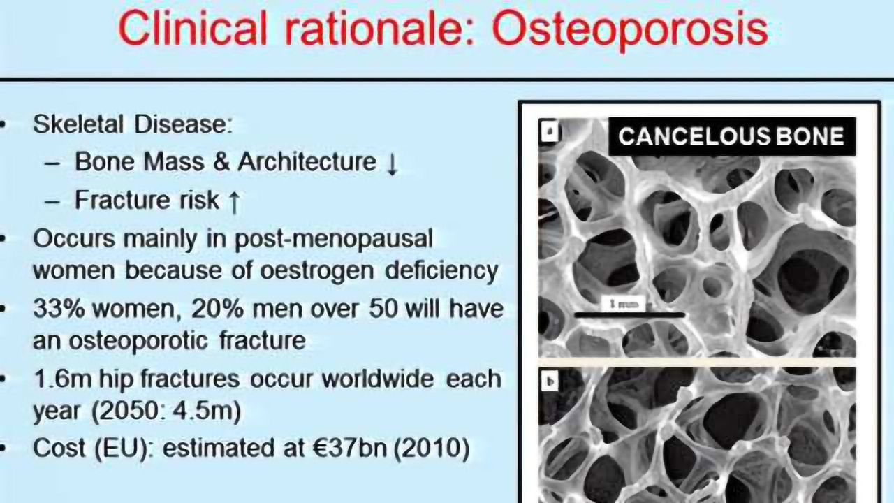 Hierarchically Structured Biomaterials for Bone-on-a-Chip Devices and Bone Tissue Engineering