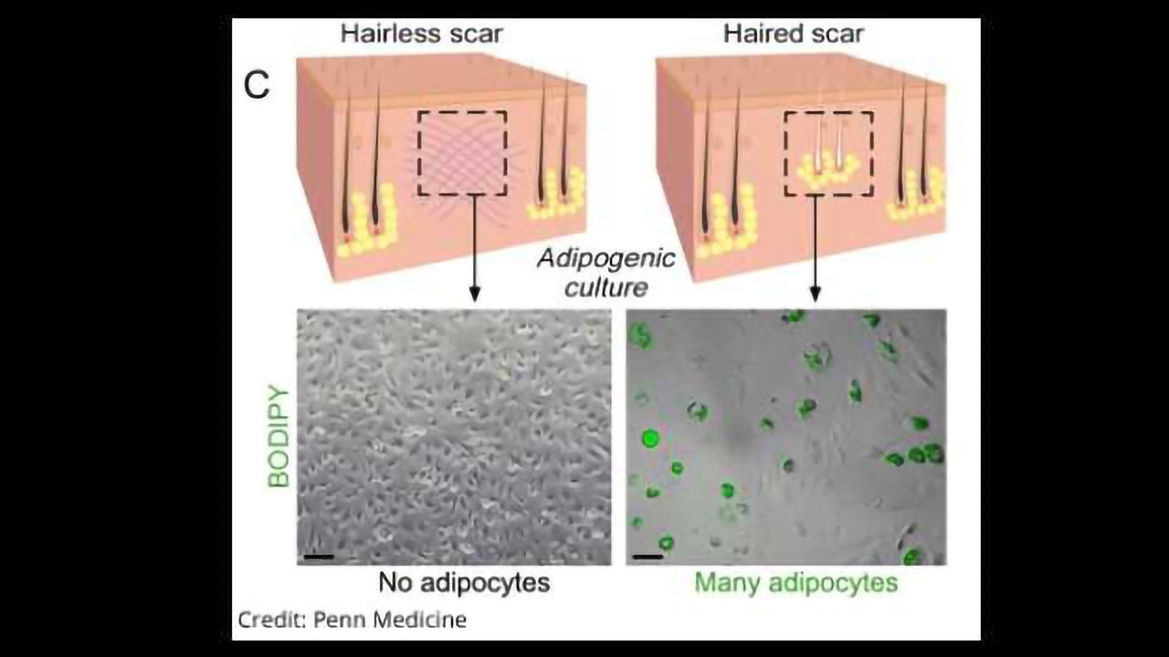 Wound Healing Without Scarring