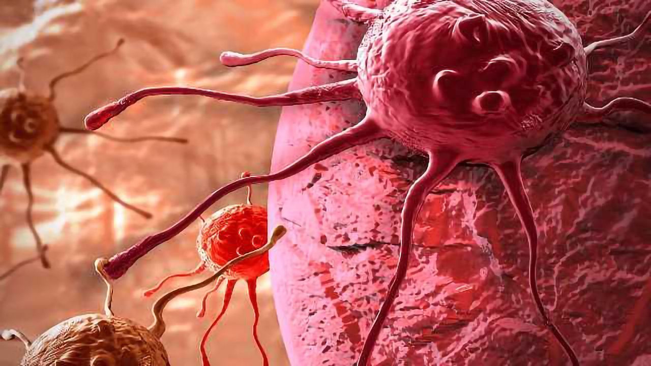 KDM5 Enzymes Implicated in Cancer Initiation, Spreading