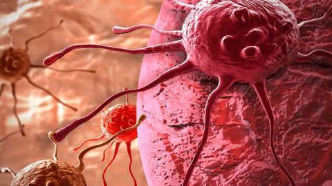 KDM5 Enzymes Implicated in Cancer Initiation, Spreading