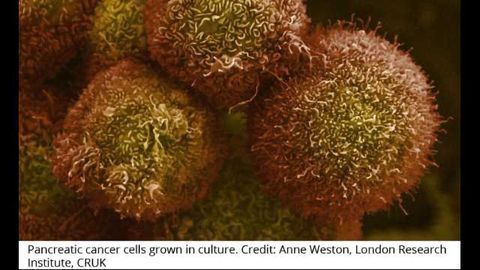 Cancer Cells Evolve During Immunotherapy