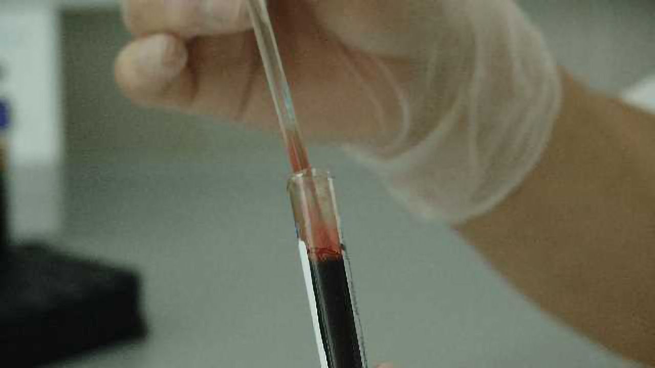 Detecting Prions in Blood