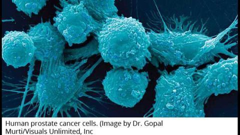 Cancer Cells Thrive Amid Genetic Chaos