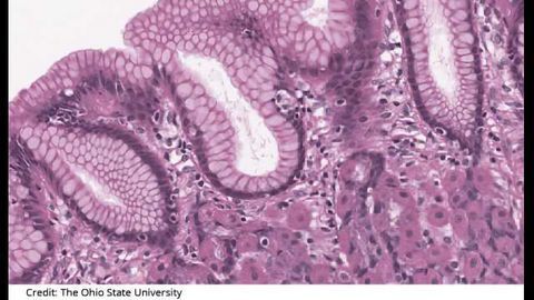 Innovative Cancer Research Partnership Formed