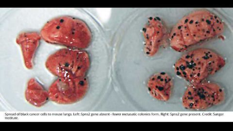23 Genes Linked to Regulation of Cancer Spread