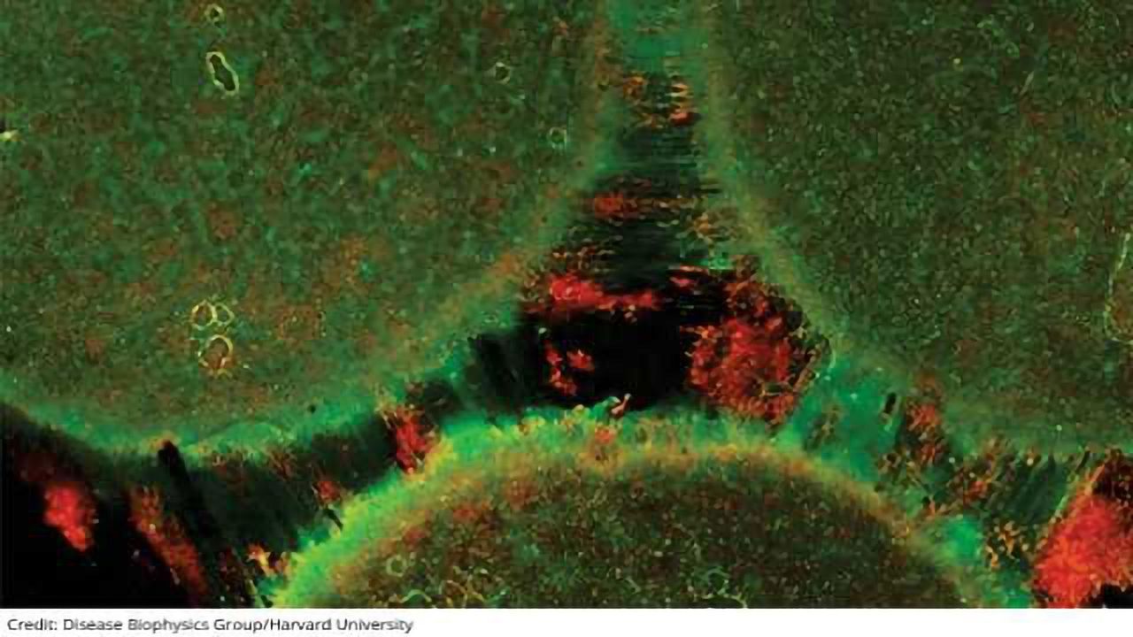 Brain-on-a-Chip Models Brain Connectivity