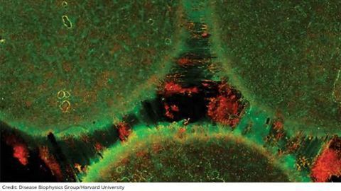 Brain-on-a-Chip Models Brain Connectivity
