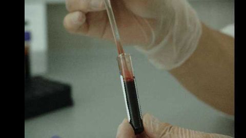 'Molecular Barcode' Predicts Ebola Outcome