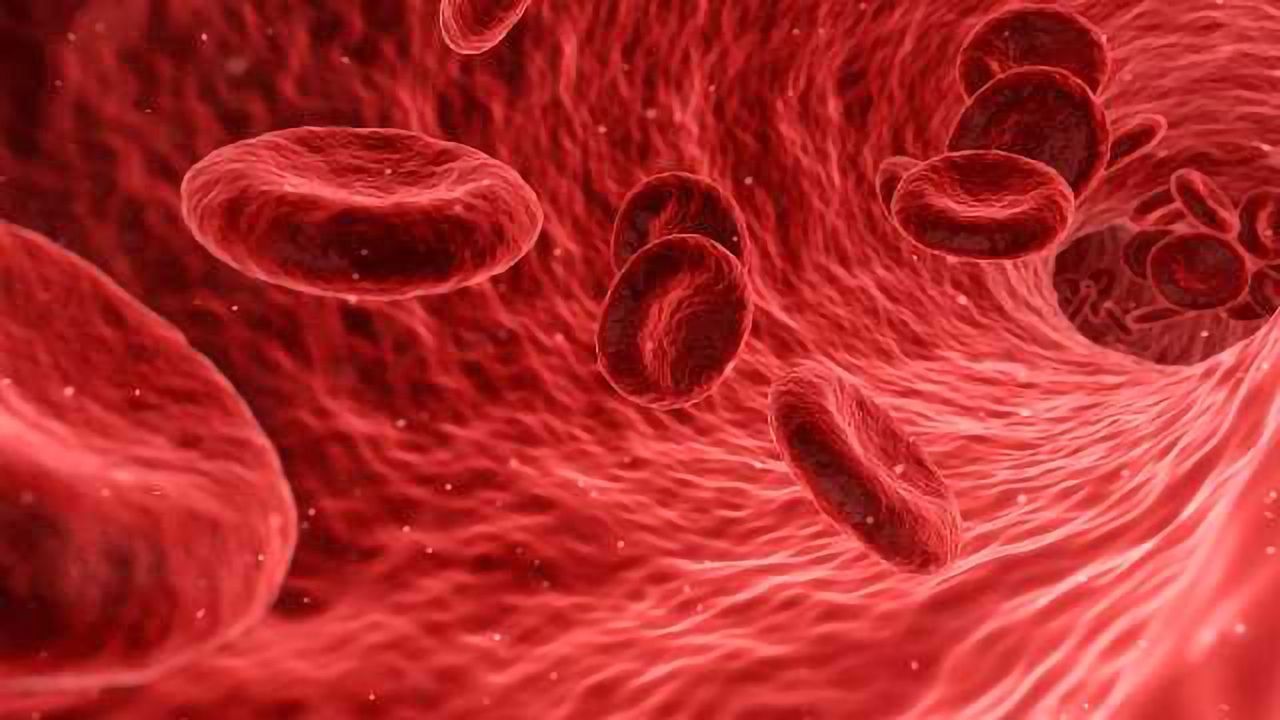 Making Strides in Sickle Cell Disease Research