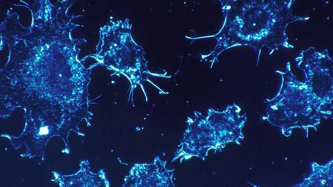 Breakthrough in Understanding Oesophageal Tumour Resistance