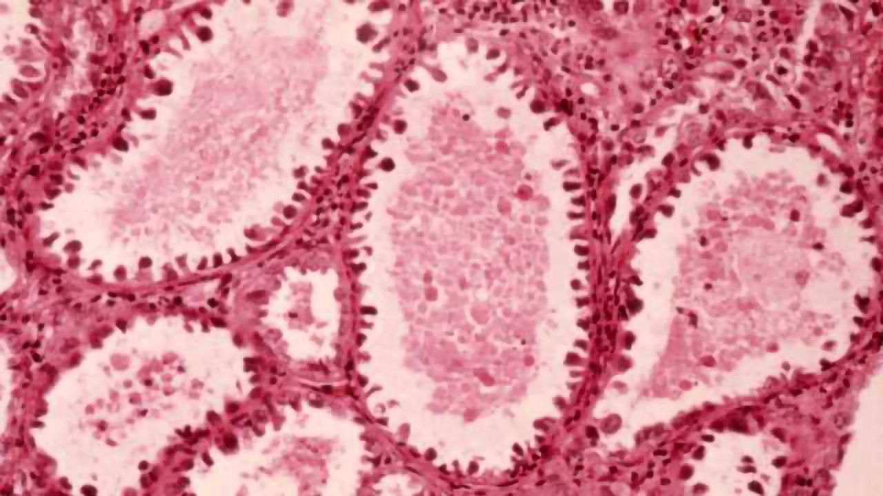Mapping the Genomic Features of Cervical Cancer