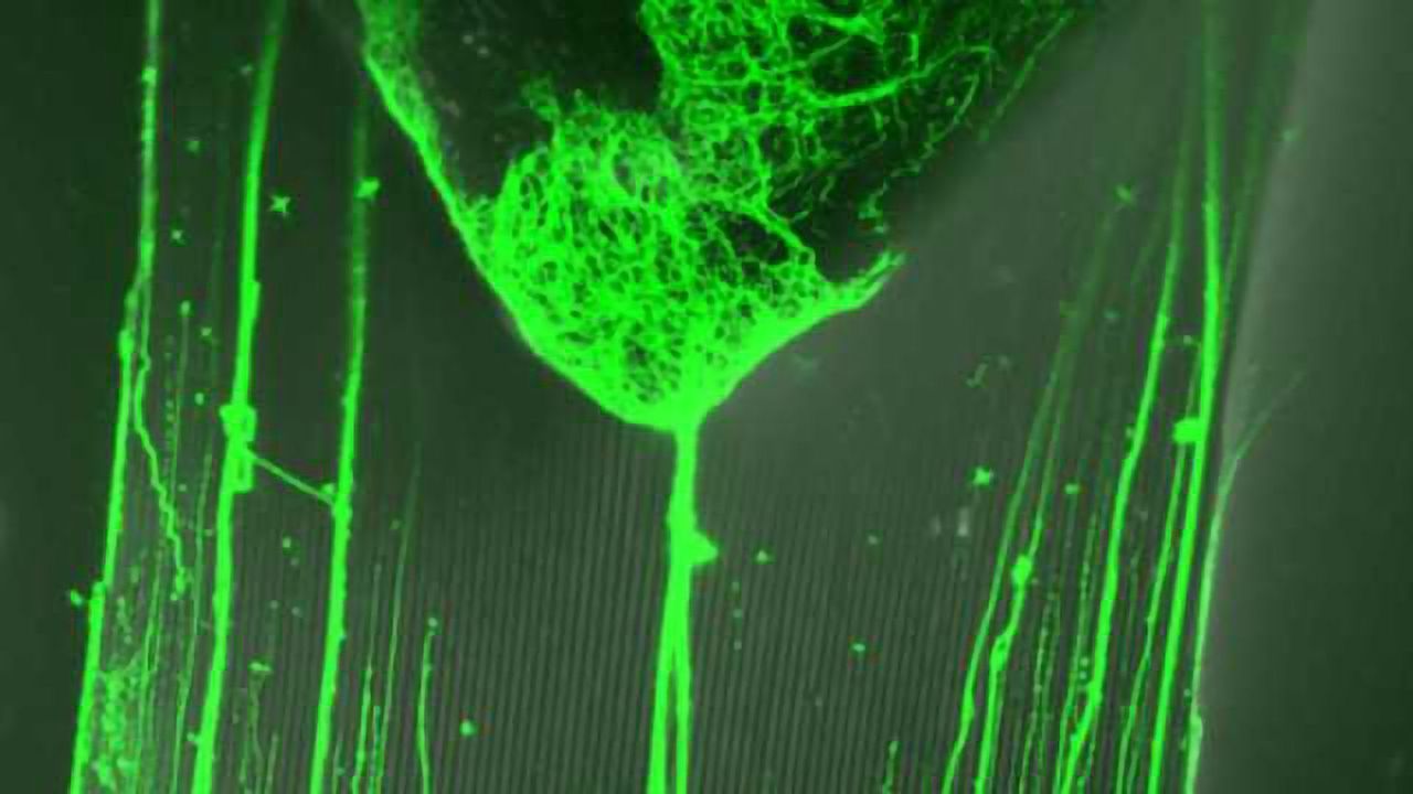 Nanometric Tracks Can Direct Nerve Growth