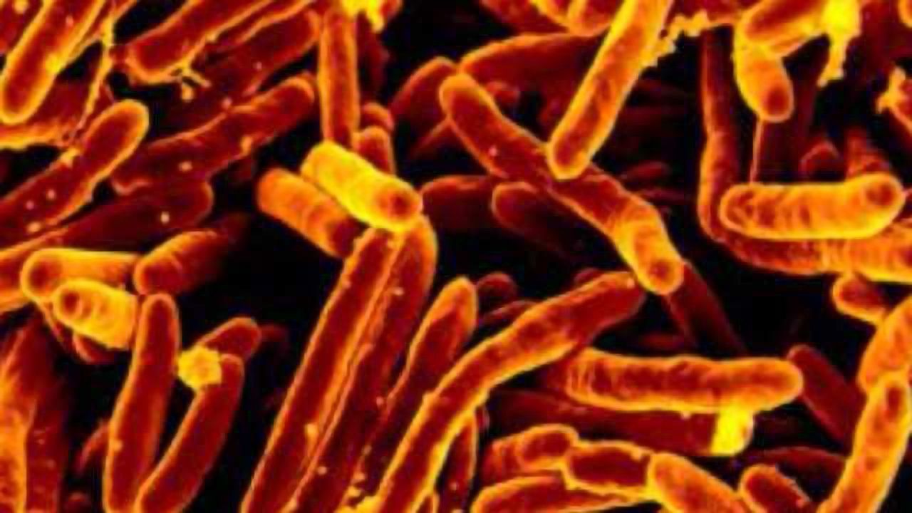 Mutation Avoidance Gene Identified in TB