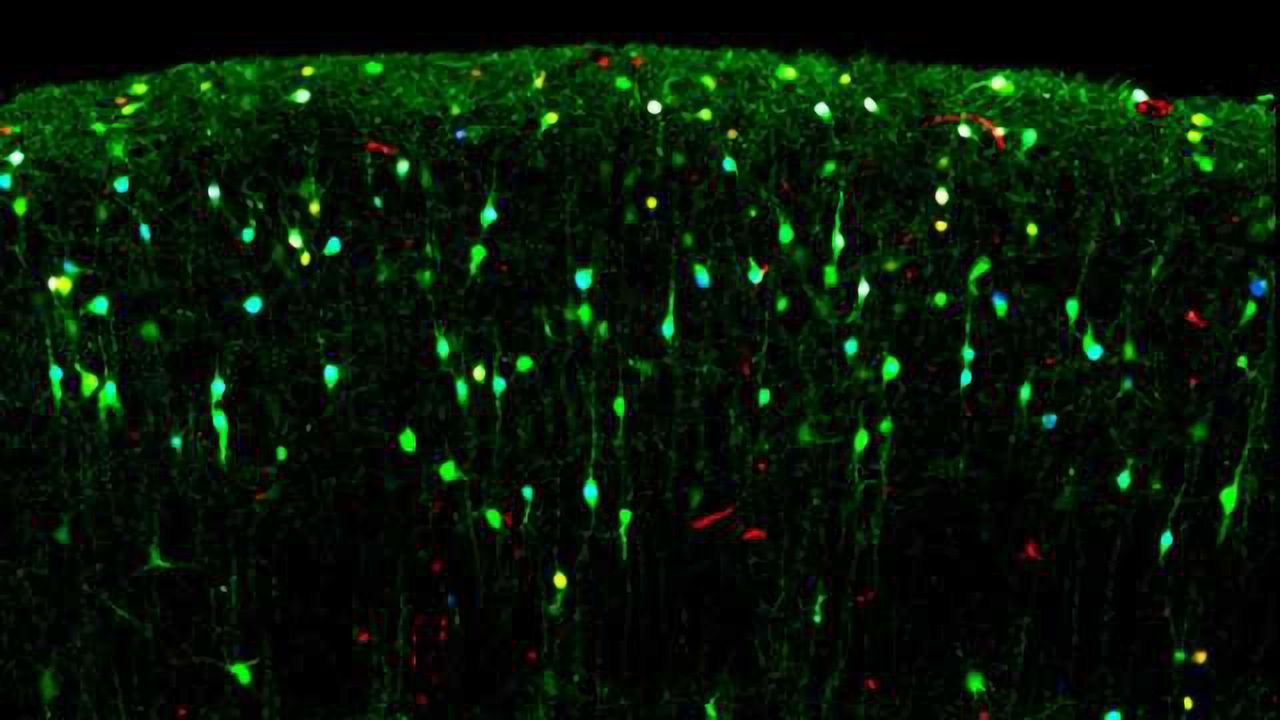 Developmental Transcriptional Diversity In Inhibitory Neurons