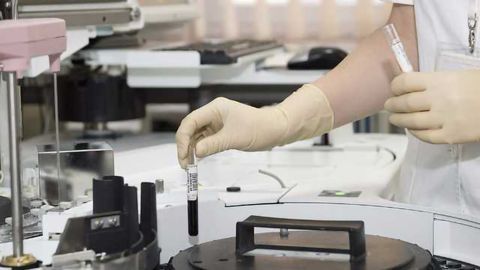 Aurinia Selects Worldwide As CRO For Phase3 Valcosporin Trial