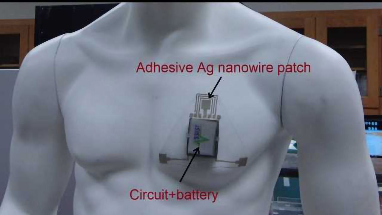 Wearable Sensor to Monitor a Person’s Skin Hydration Has Been Developed