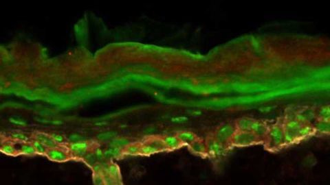 Exploring Why Protein Production Goes Haywire in Cancer